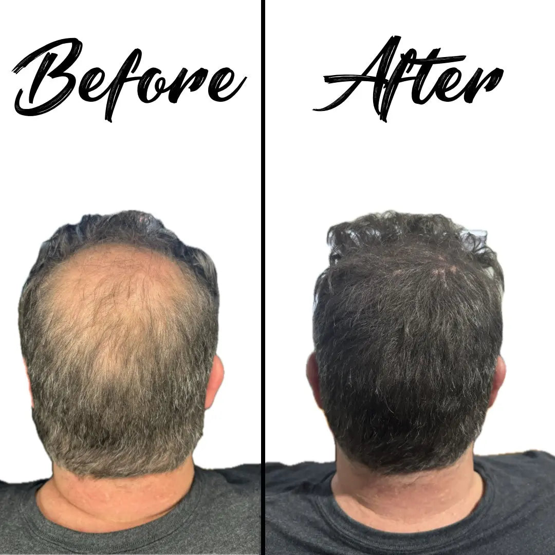 Barber Works Hair Fibers (28g) - Onyx Black | Instant Thicker Look for Men & Women - BUYBARBER.COM