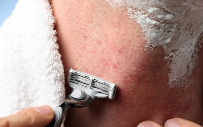 Preventing Razor Bumps and Irritation: A Pro Guide
