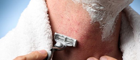 How To Get Rid Of Razor Bumps and Irritation