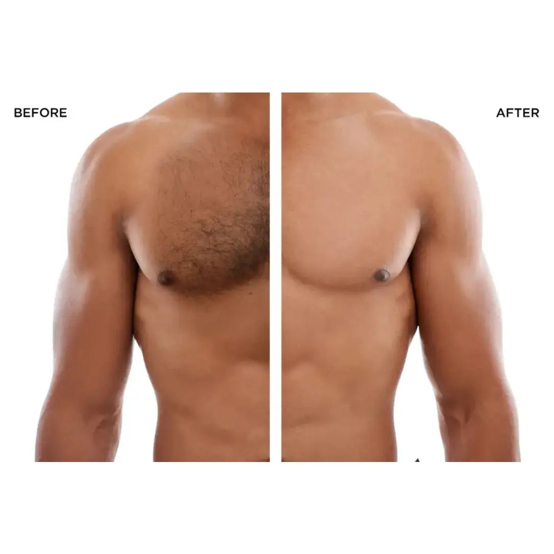 Before and after comparison of a person's chest hair removal on a white background.